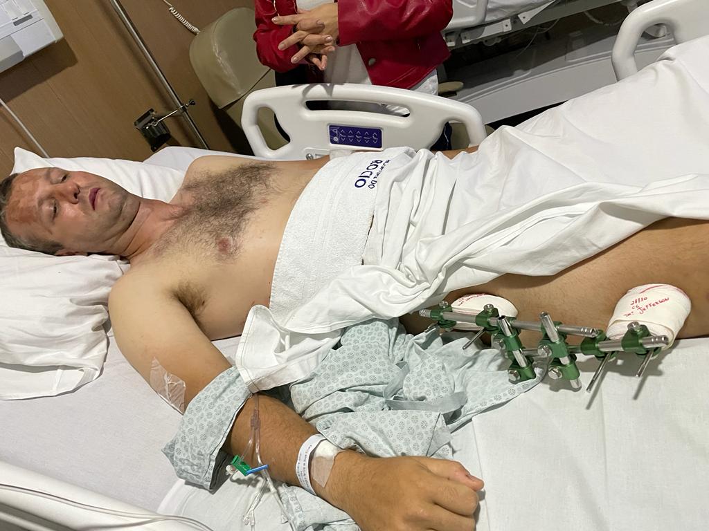 Duas cirurgias, sequelas para sempre e muita dor.